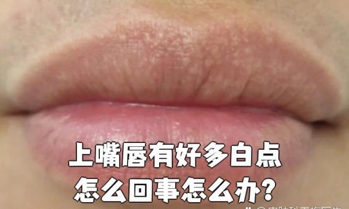 手臂与后背相连的地方出汗-专业手臂与后背相连的地方出汗怎么回事平台-手臂与后背连接处疼痛